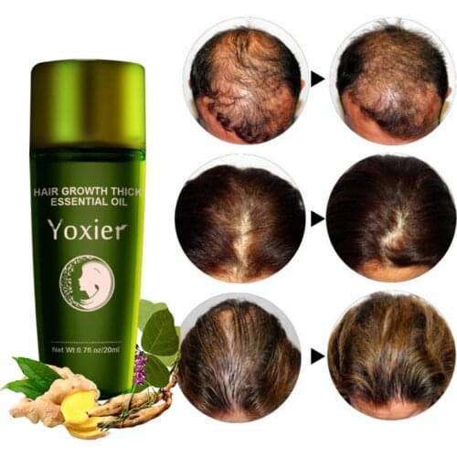 20ml Hair Growth Essential Oil Shampoo Hair Loss Product Thick Fast Repair Growing Treatment Liquid Hair Care & Styling