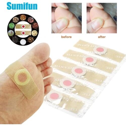 Sumifun 12pc Foot Corn Removal Killer Calluses Plantar Warts Thorn Pain Relief Curative Plaster Medical Sticker Curative Plaster