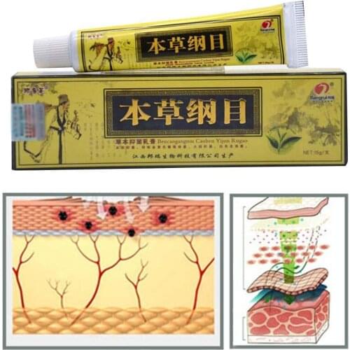 1 Pcs Eczema Psoriasis Antibacterial Ointment Treatment Herbal Problems Cream Care Medicine Chinese Natural Skin Pruritus L0H2