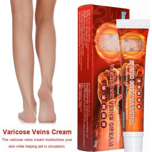 20g Varicose Veins Cream Varicosity Angiitis Remedy Ointment Relief Veins Pain Phlebitis Legs Varicose Veins Cream For Legs Care