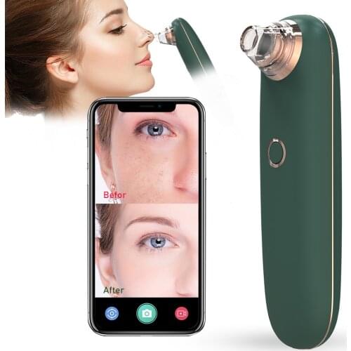 Visual Blackhead Remover Electric Black Dot Remover Beauty Skin Care Cleaner APP Control Heating Nose Face Deep Cleansing