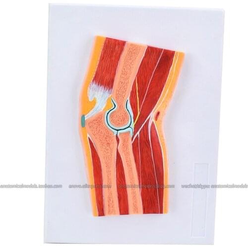 CMAM/12712 Elbow Joint Section, Medical Extremities Anatomical Human Model
