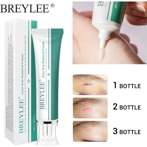 BREYLEE Acne Scar Removal Cream Remove Stretch Marks Surgical Scar Burn Pigmentation Corrector Acne Repair Scar Cream Skin Care