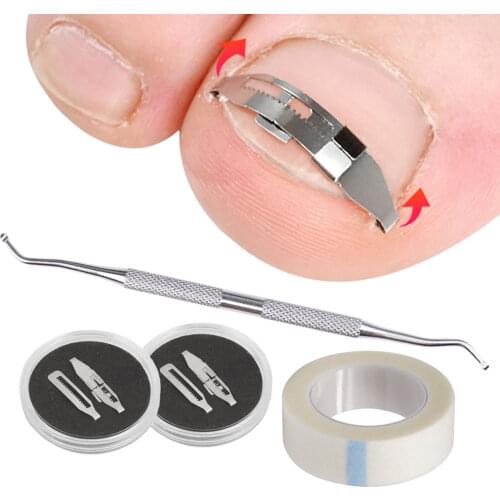 Ingrown Toenail Corrector Correction Buckle Pedicure Carbon Steel Foot Care Embed Toe Nail Treatment Professional Ingrown