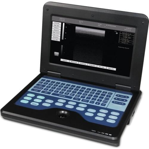 2021 Best selling CE APPROVE ultrasound scanner portable ultrasound machine