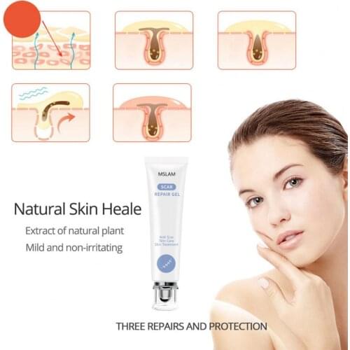 20ML Acne Mark Ointment Anti-allergic Mild Plant Extracts Acne Scar Removal Skin Repair Cream for Beauty