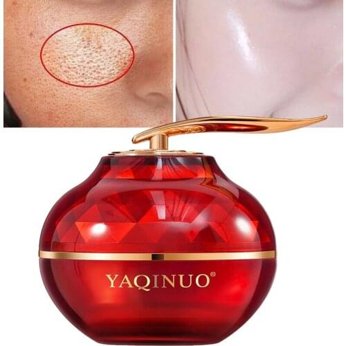 Face Cream Whitening Retinol Sodium Hyaluronate Moisturizing Brighten Even Skin Tone Acne Anti-Aging Shrink Pores Skin Care 30g