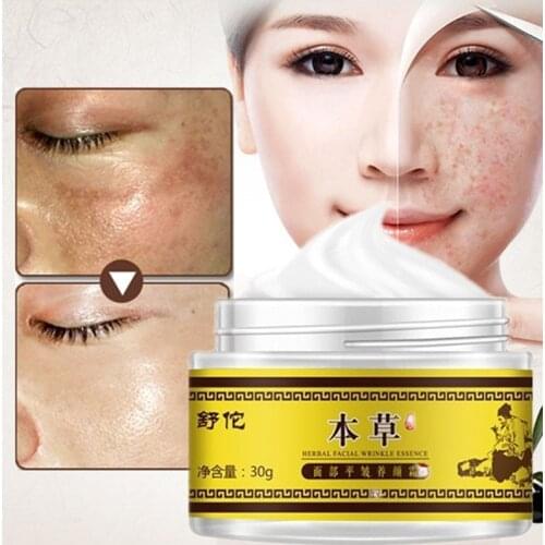 Efficient Skin whitening freckle cream Chinese herbal face cream remove dark spots Face Brightening Anti-aging Repair Serum 30g