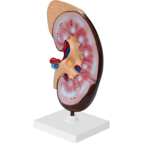 PVC Renal Anatomical Model Kidney Model Human Anatomy Organ Medical Teaching Supplies Biological Kidneys Models Supplier