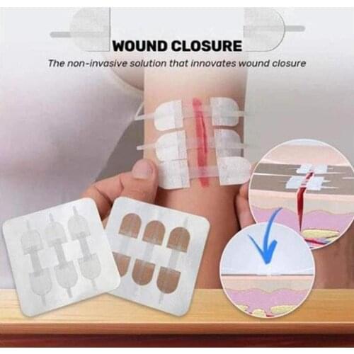 3pcs/set Outdoor Zipper Band-aids For Quick Suturing Of Wounds With Free-seam Tape New Type Of Needle-free Wound Tape