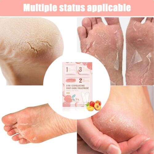 Foot Peeling Mask Exfoliating Heels Calluses Remove Foot Patches Dead Skin Remover Pedicure Socks Foot Care Tool 1Pair