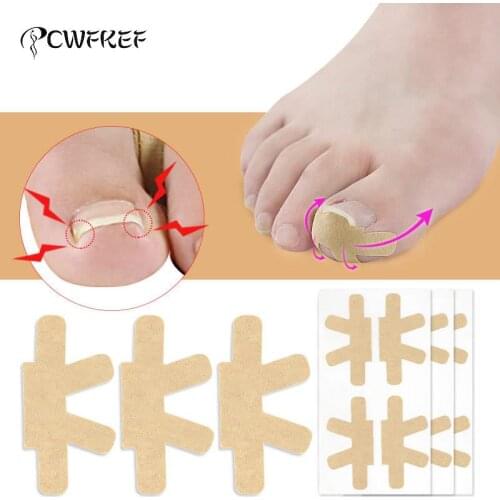 Ingrown Toenail Corrector Stickers Paronychia Treatment Pedicure Toe Nail Care Corrector Patch Correction Stickers