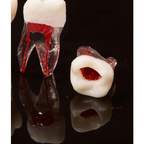1Pc Dental Tooth Root Canal Model For RCT Practice Pulp Cavity Clear Resin dentis equipment