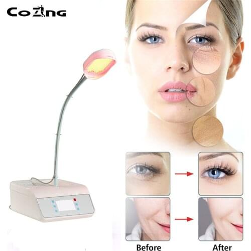 Blue and red light therapy kills acne-causing bacteria without damaging the skin