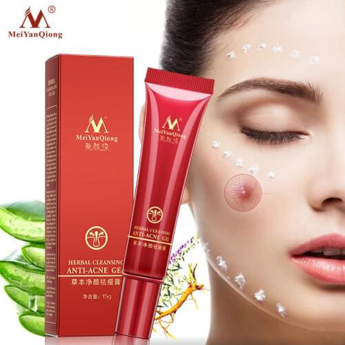 MeiYanQiong Herbal Acne Cleansing Face Cream Anti-Acne Treatment Pimples Blains Removal Cream Control Oil Fade Acne Scars