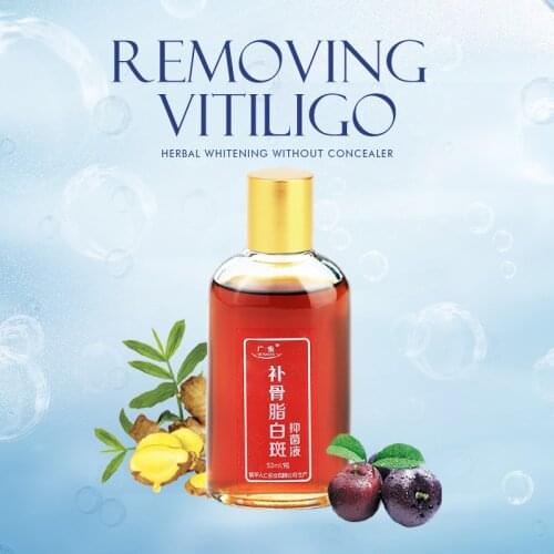 Vitiligo White Spot Treatment Fluid Concealer Repair Color Dodge Weaken Lighten Patch Floccosoids Leukasmus Measling Set/50ml