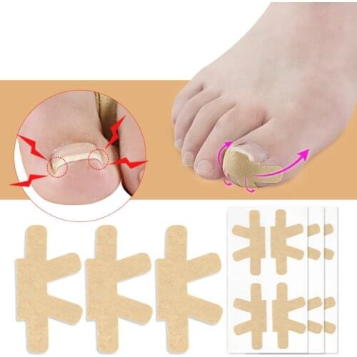 1 Sheet Ingrown Toenail Corrector Sticker Paronychia Treatment Fixer Recover Corrector Bunion Pedicure Foot Toe Nail Care Tool