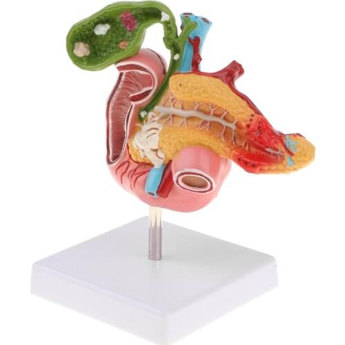 1:1 Life Size Anatomical Human Pancreas Duodenum Gallbladder Pathology Model, Lab Office Equipment Ornament for Students