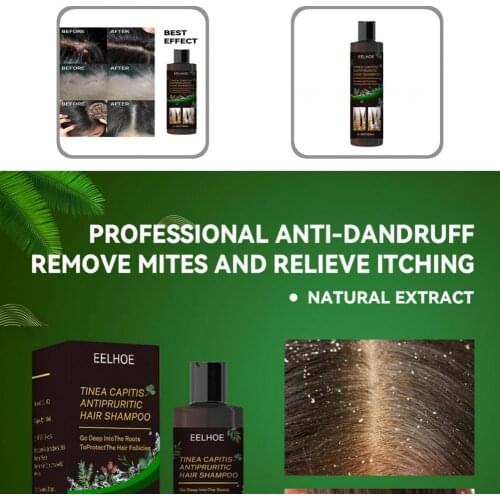 Non-irritating Hair Products Hair Dandruff Removal Shampoo for Travel