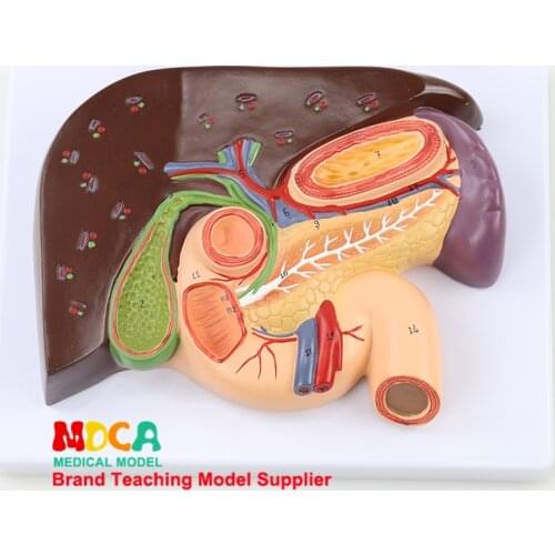Teaching of Splenic Anatomical Model Medicine MGZ004 in Duodenal Gallstone Model of Liver Model