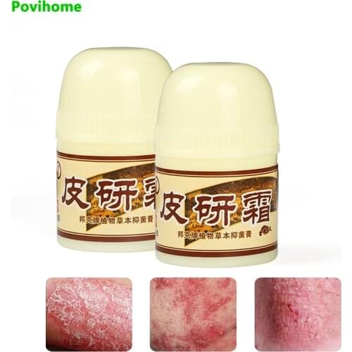 1pcs Remove Fungus Cream Anti-itch Ointment Eczema Dermatitis Pruritus Antipruritic Medicine Effective Antibacterial Skin Care