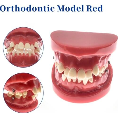 Orthodontic Tooth Model Demonstration Teaching Doctor-Patient Communication Results Show