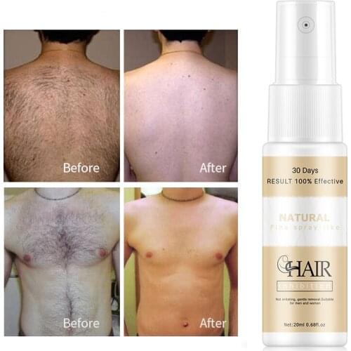 Long-lasting Inhibitor Of Hair Growth New Hair Growth Inhibitor Facial Stop Growth Spray Face Legs Body Hair Stop Growth