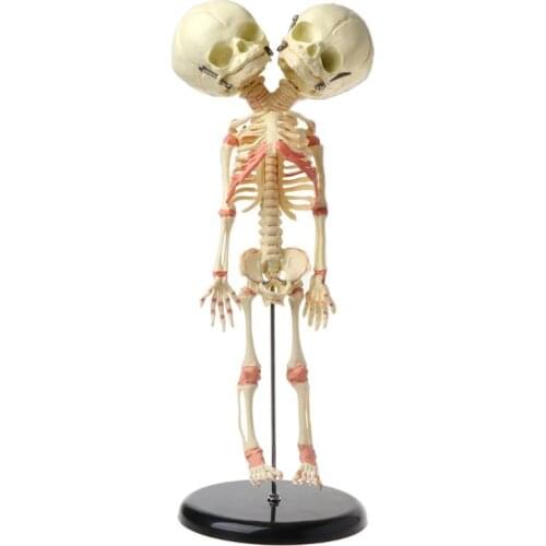 37cm Human Double Head Baby Skull Skeleton Anatomy Brain Display Study Teaching Anatomical Model G6DD