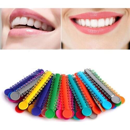 40Pcs Dental Ties Elastic Rubber Bands Oral Ligature Orthodontics Dentist Teeth whitening Tools Elasticity For Teeth
