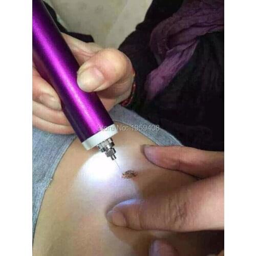 New arrival electric cautery Spot Removal machine Face spa device Massage Laser spot removal pen skin Spot remover