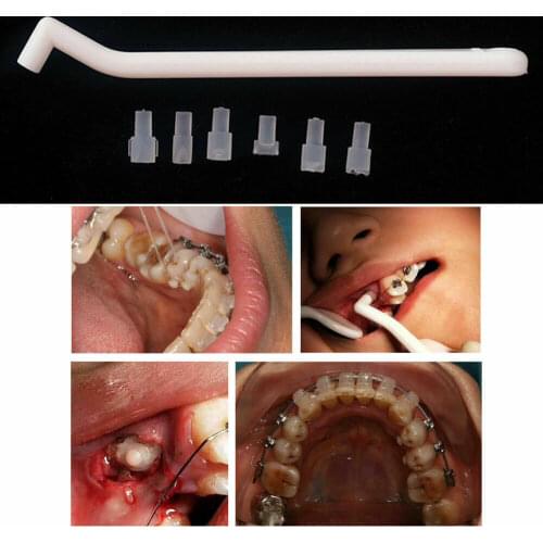 5Kits Dental Mini Orthodontic Accessories Injection Mould Lingual Brackets Button Bite Tongue Tamer Handle+Moldsx6 Wholesale