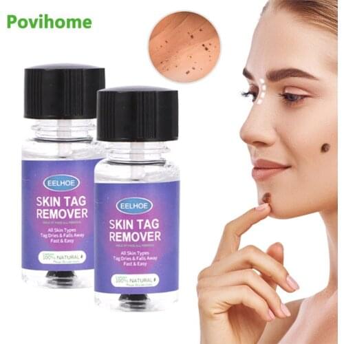 10/30ml Herbal Warts Removal Cream Remove Skin Tag Corn Wart Sarcoma Liquid Foot Calluses Antibacterial Ointment Care Plaster