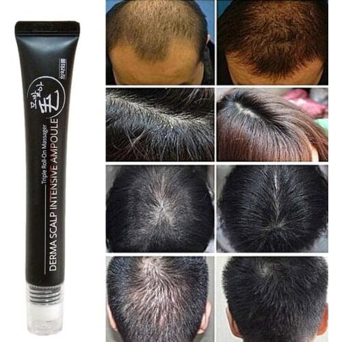 Hair Line Growth Serum Derma Scalp Intensive Ampoule Triple Roll Massager Fast Hair Regrow Hair Loss Essence
