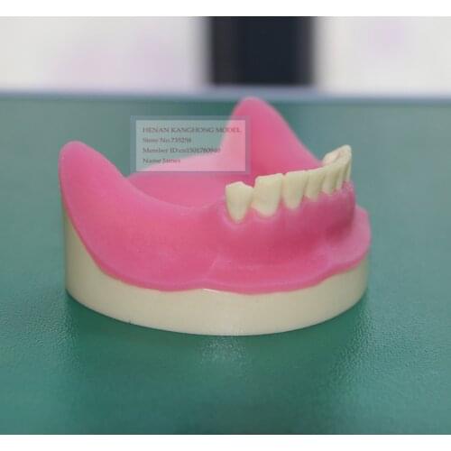 Teeth Planting Practice Model,Soft Gum Teeth Planting Practice Model,Tooth Model,Oral Skills Training Model