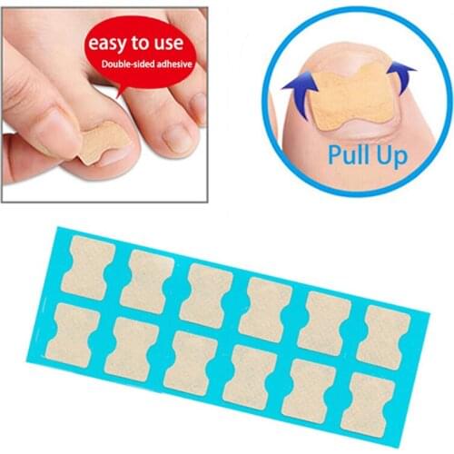 36pcs/pack Professional Embedded Toe Nail Corrector Foot Care Toenail Patch Ingrown Toenail Correction Stickers Pedicure Tool