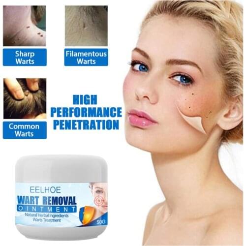 10-50g Wart Remover Veilig Pijnloos Skin Tag Verwijderen Zalf Snelwerkende Remover Crème Voor Wratten Mollen Maïs Voor Alle Skin