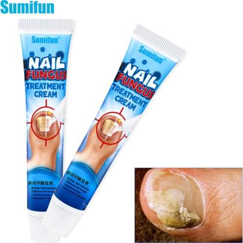 New Sumifun 1/2pcs Nails Treatments Cream Nail Foot Protector Nail Fungus Onychomycosis Treatment Herb Nails Repair Cream P1148