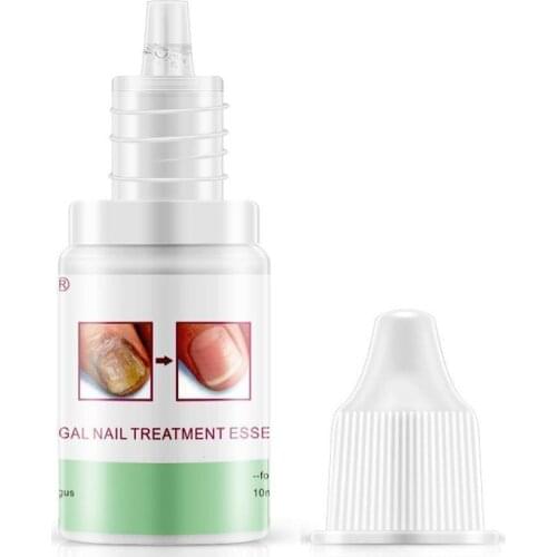 10ml Anti Fungal Treatment Nail Nail Fungus Treatment Infection Finger Care For Onychomycosis Paronychia Herbal Nails Toe V8L0