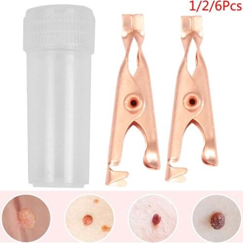 Skin Tags Remover Wart Tattoo Clip Blackhead Skin Blemish Removers Coppers Tags
