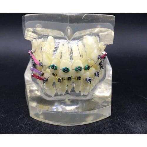 Dental Tooth Model with Colorful brackets M3005/ Teaching demonstration Teeth model/Anchor nail traction correction tooth model