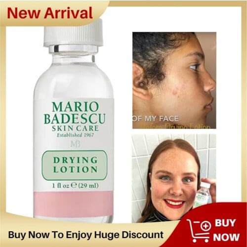 29ml effective Acne Treatment Mario Badescu Drying Lotion 29ml Anti Acne Serum Pimple Blemish Removal