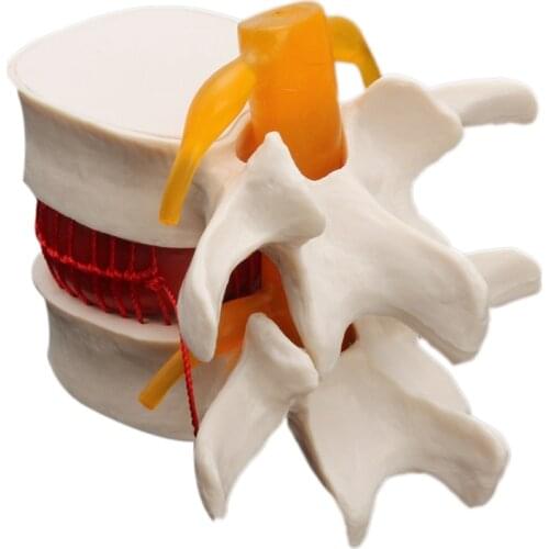 Human Anatomy Skeleton Spine Lumbar Disc Herniation Teaching Model Brain Skull Traumatic School Supplies Medical Instrume