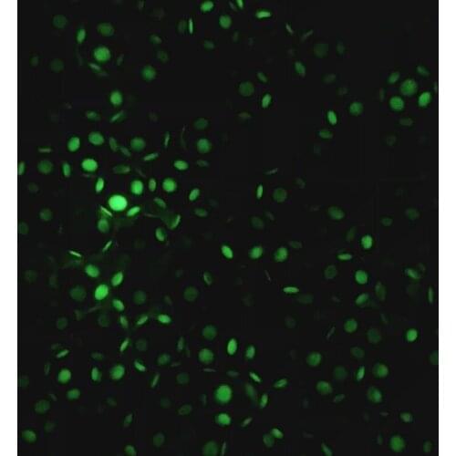 Kwoi vita 100pcs/lot 20mm Resin Glow Enamel polka dot acrylic beads for Chunky jewelry making