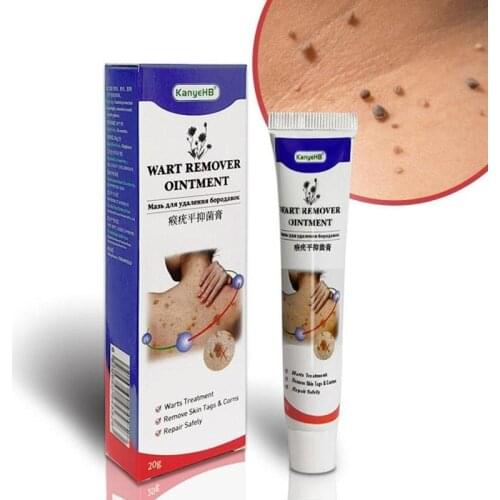 Warts Remover Antibacterial Ointment Wart Treatment Cream Skin Tag Remover Herbal Extract Corn Plaster Warts Ointment 1pc 20g
