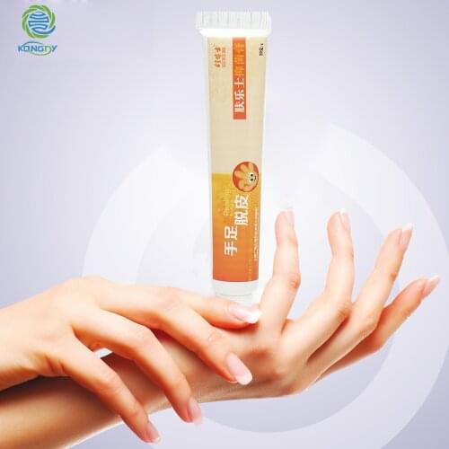KONGDY Feet Dead Skin Removal Ointment Hands Foot Peeling Cream Moist Calluses Removal Heel Chapped Peeling Repair Frostbite