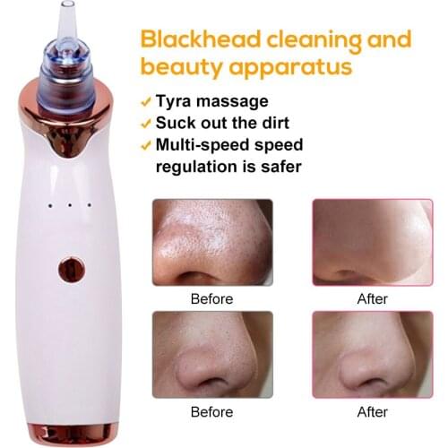 SALORIE Vacuum Pore Cleaners