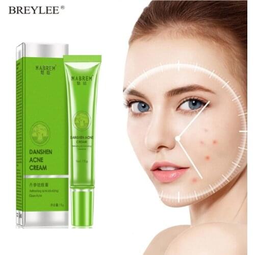 Anti Acne Removal Cream Acne Treatment Fade Acne Spots Oil Control Shrink Pores Whitening Moisturizing Acne Cream Skin Care 15g