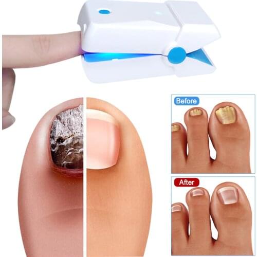 LASPOT 905nm Diode Cold Laser for Nail Fungus Treatment LLLT Fungal Nails Fungus Remover 2020 Home Physiotherapy Apparatus