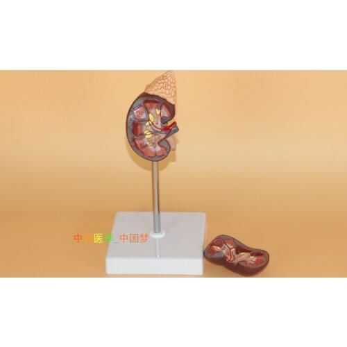 Human kidney Anatomical Model Urology 23*10.5*6.5cm free shipping