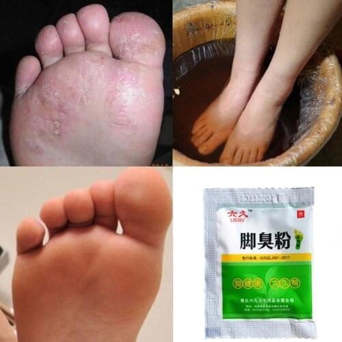 Fungal Infections Foot Bath Powder Feet Care Foot odor Foot itch Athletes Foot Foot Odor Sweat Itching Peeling Beriberi Foot